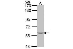 WB Image Sample (30 ug of whole cell lysate) A: Raji 7. (IMPDH1 Antikörper  (Center))