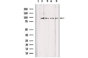 Western blot analysis of extracts from various samples, using PYGL antibody. (PYGL Antikörper  (Internal Region))
