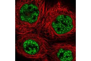 Immunofluorescent staining of human cell line A-431 shows localization to nuclear speckles.