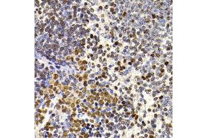 Immunohistochemistry of paraffin-embedded rat spleen using HIRIP3 antibody (ABIN5974221) at dilution of 1/100 (40x lens). (HIRIP3 Antikörper)