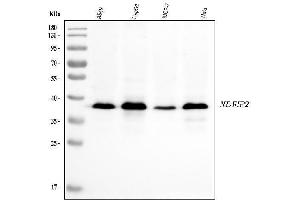 Western blot analysis of NDFIP2 using anti-NDFIP2 antibody (ABIN7600173).