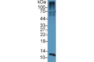 Detection of S100A4 in Mouse Placenta lysate using Polyclonal Antibody to S100 Calcium Binding Protein A4 (S100A4) (s100a4 Antikörper  (AA 1-101))