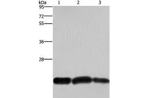 Western Blot analysis of A375 and Raji cell, Human fetal brain tissue using CBX3 Polyclonal Antibody at dilution of 1:600 (CBX3 Antikörper)