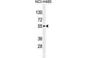Western blot analysis in NCI-H460 cell line lysates (35ug/lane) using MIER2 Antibody (N-term). (MIER2 Antikörper  (N-Term))