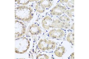 Immunohistochemistry of paraffin-embedded human stomach using CGB7 antibody at dilution of 1:100 (x40 lens). (CGB7 Antikörper)