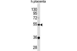 Western Blotting (WB) image for anti-Tektin 3 (TEKT3) antibody (ABIN3000961) (Tektin 3 Antikörper)