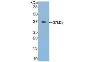 Western blot analysis of recombinant Human FN. (Fibronectin Antikörper  (AA 313-607))