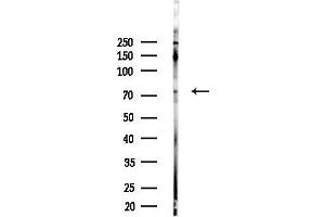 anti-PAK3 (PAK3) (pSer154) antibody