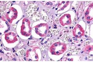 Immunohistochemistry (Formalin/PFA-fixed paraffin-embedded sections) of human kidney, renal tubules with TAAR6 polyclonal antibody . (TAAR6 Antikörper  (Cytoplasmic Domain))