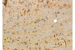 ABIN6266149 and ABIN6277117 at 1/100 staining Rat brain tissue by IHC-P.
