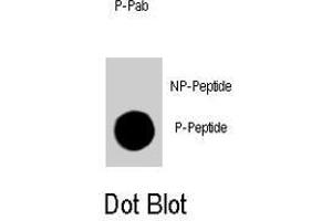 Dot blot analysis of CDKN1B (phospho T198) polyclonal antibody  on nitrocellulose membrane. (CDKN1B Antikörper  (pThr198))