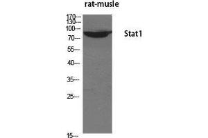 Western Blot (WB) analysis of specific cells using Stat1 Polyclonal Antibody. (STAT1 Antikörper  (Tyr1217))