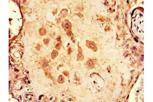 Immunohistochemistry of paraffin-embedded human placenta tissue using ABIN7146624 at dilution of 1:100 (ARPP19 Antikörper  (AA 2-105))
