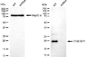 Western blotting analysis using ITGB1BP1 antibody (ABIN7799068). (ITGB1BP1 Antikörper)