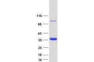 Western Blotting (WB) image for Tropomyosin 3 (TPM3) (Transcript Variant 5) protein (Myc-DYKDDDDK Tag) (ABIN2734394)
