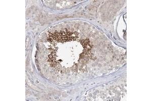 Immunohistochemical staining of human testis with ADAMTS12 polyclonal antibody  shows strong cytoplasmic positivity in subsets of seminiferus duct cells at 1:50-1:200 dilution. (ADAMTS12 Antikörper)