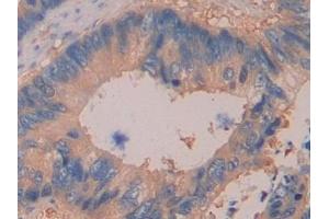Immunohistochemistry (IHC) image for anti-Dimethylarginine Dimethylaminohydrolase 2 (DDAH2) (AA 31-265) antibody (ABIN7435682)