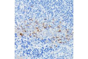 Immunohistochemistry of paraffin-embedded mouse spleen using CD225/IFITM1 antibody (ABIN1680390, ABIN3018715, ABIN3018716 and ABIN6220553) at dilution of 1:100 (40x lens). (IFITM1 Antikörper  (C-Term))