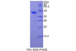 SDS-PAGE (SDS) image for Bone Morphogenetic Protein 10 (BMP10) (AA 315-424) protein (His tag,GST tag) (ABIN2122493) (BMP10 Protein (AA 315-424) (His tag,GST tag))