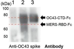 Purified protein identities were further confirmed by Western blot analysis using an anti‐OC43 spike antibody.