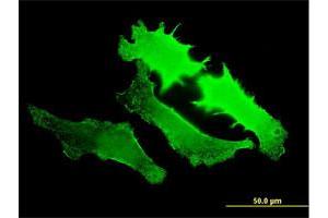 Immunofluorescence (IF) image for anti-Guanylate Cyclase 2D, Membrane (Retina-Specific) (GUCY2D) (AA 521-630) antibody (ABIN561216)