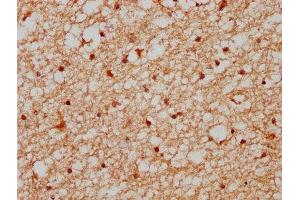 Immunohistochemistry (IHC) image for anti-XPA Binding Protein 2 (XAB2) (AA 750-840) antibody (ABIN7164186)