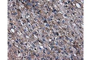 Immunohistochemical staining of paraffin-embedded liver tissue using anti-SATB1mouse monoclonal antibody. (SATB1 Antikörper)