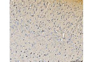 IHC analysis of Histidine Decarboxylase/HDC using anti-Histidine Decarboxylase/HDC antibody (ABIN7599827). (HDC Antikörper  (AA 12-662))