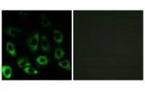 Immunofluorescence analysis of A549 cells, using MBTPS2 antibody. (MBTPS2 Antikörper)