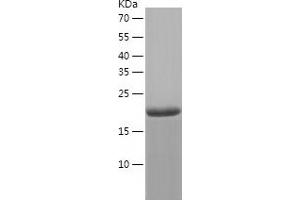 Western Blotting (WB) image for Charged Multivesicular Body Protein 6 (CHMP6) (AA 1-201) protein (His tag) (ABIN7122256) (CHMP6 Protein (AA 1-201) (His tag))