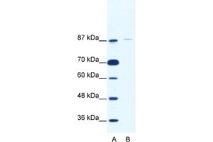 Western Blotting (WB) image for anti-TATA Box Binding Protein (TBP)-Associated Factor, RNA Polymerase I, C, 110kDa (TAF1C) (C-Term) antibody (ABIN2780707)