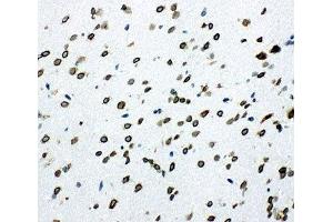 Immunohistochemistry (IHC) image for anti-SHC (Src Homology 2 Domain Containing) Transforming Protein 1 (SHC1) (C-Term) antibody (ABIN3032555)