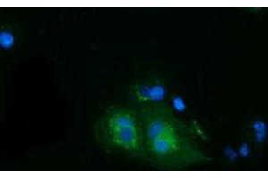 Immunofluorescence (IF) image for anti-Heat Shock Protein 70 (HSP70) antibody (ABIN1498749) (HSP70 Antikörper)