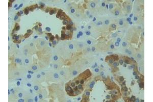 DAB staining on IHC-P; Samples: Human Kidney Tissue (RYK Antikörper  (AA 308-570))