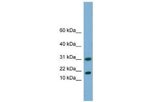 EIF5A2 antibody used at 1 ug/ml to detect target protein. (EIF5A2 Antikörper  (N-Term))