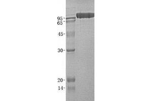 Western Blotting (WB) image for Serpin Peptidase Inhibitor, Clade G (C1 Inhibitor), Member 1 (SERPING1) (Transcript Variant 1) protein (His tag) (ABIN2731840)