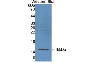 Western Blotting (WB) image for anti-Serpin Peptidase Inhibitor, Clade G (C1 Inhibitor), Member 1 (SERPING1) antibody (Biotin) (ABIN1172652)