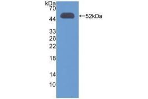 Detection of Recombinant OXCT1, Human using Polyclonal Antibody to 3-Oxoacid Coenzyme A Transferase 1 (OXCT1) (OXCT1 Antikörper  (AA 40-489))