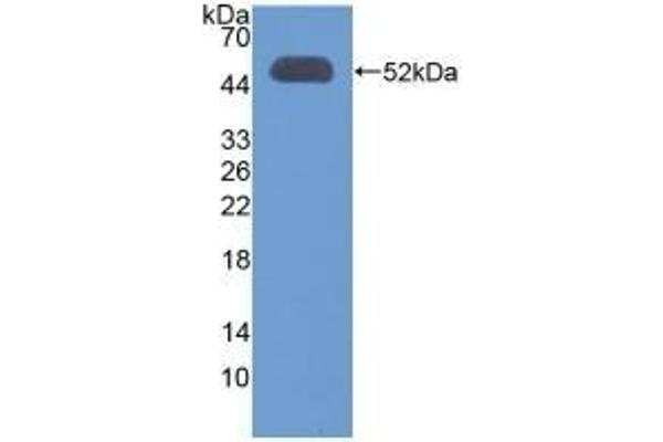 OXCT1 Antikörper  (AA 40-489)