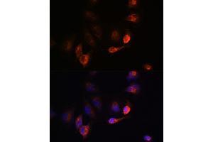 Immunofluorescence analysis of U-251MG cells using B antibody (ABIN6129977, ABIN6137413, ABIN6137415 and ABIN6220894) at dilution of 1:100. (BACE1 Antikörper  (AA 22-322))