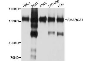Western blot analysis of extracts of various cell lines, using SMARCA1 antibody. (SMARCA1 Antikörper)