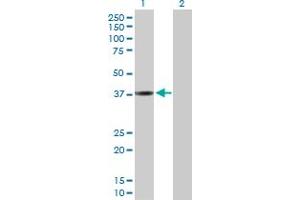 Western Blot analysis of CTSL1 expression in transfected 293T cell line by CTSL1 MaxPab polyclonal antibody. (Cathepsin L Antikörper  (AA 1-333))