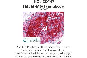 Image no. 1 for anti-Basigin (Ok Blood Group) (BSG) antibody (ABIN1723368) (CD147 Antikörper)