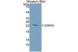 Western Blotting (WB) image for anti-Glucokinase (Hexokinase 4) Regulator (GCKR) (AA 90-286) antibody (ABIN3201594) (GCKR Antikörper  (AA 90-286))
