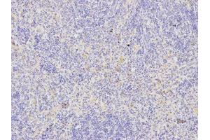 Immunohistochemistry (IHC) image for anti-TNF Receptor Superfamily, Member 6 (FAS) (AA 150-250) antibody (ABIN6213700) (FAS Antikörper  (AA 150-250))