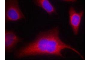 Immunofluorescence staining of methanol-fixed Hela cells using PKD/PKCm(Phospho-Ser910) Antibody. (PKC mu Antikörper  (pSer910))
