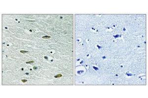 Immunohistochemistry (IHC) image for anti-Insulin-Like Growth Factor 1 Receptor (IGF1R) (Tyr1346) antibody (ABIN1848190) (IGF1R Antikörper  (Tyr1346))