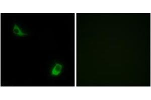 Immunofluorescence analysis of LOVO cells, using FPRL2 Antibody. (FPR3 Antikörper  (AA 304-353))