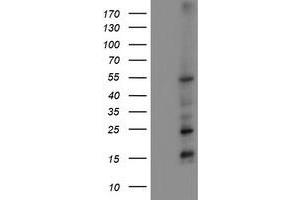 Western Blotting (WB) image for anti-Myocyte Enhancer Factor 2C (MEF2C) antibody (ABIN1499366) (MEF2C Antikörper)