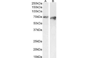 ABIN570954 (2 μg/mL) staining of HeLa (A) and (1 μg/mL) of HepG2 (B) cell lysate (35 μg protein in RIPA buffer). (PCSK9 Antikörper  (AA 214-228))